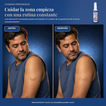 2x1 SinLipomas - Pleyer