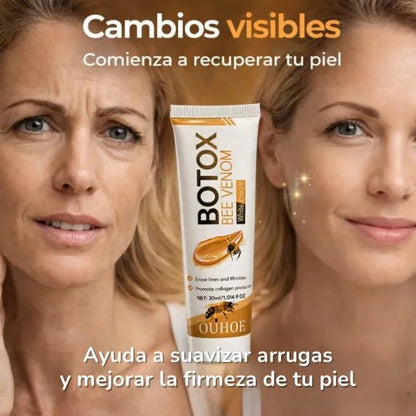 Botox Bee Venom - Pleyer