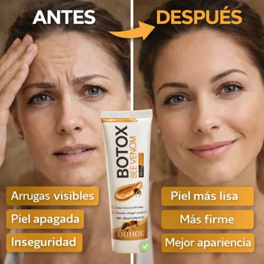 Botox Bee Venom - Pleyer