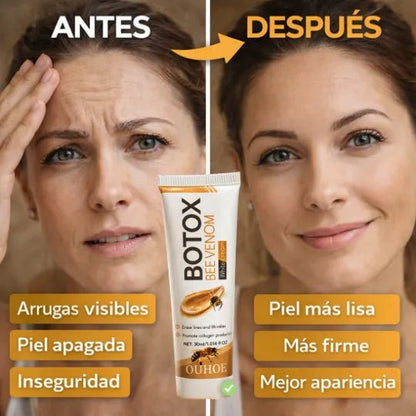 Botox Bee Venom - Pleyer