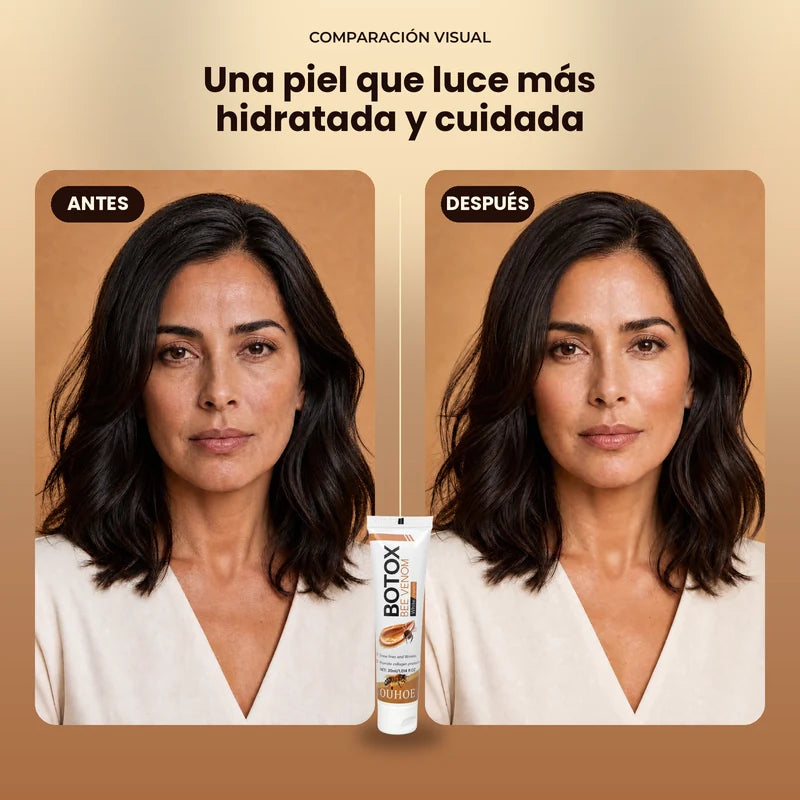 Botox Bee Venom (2x1)