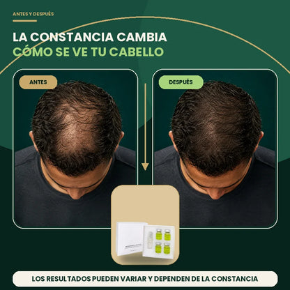 Antes y después de la apariencia de cobertura en la coronilla con Kit Capilar Pleyer